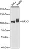 Western blot analysis of extracts of various cell lines, using NR3C1 antibody (15-135) at 1:1000 dilution.<br/>Secondary antibody: HRP Goat Anti-Rabbit IgG (H+L) at 1:10000 dilution.<br/>Lysates/proteins: 25ug per lane.<br/>Blocking buffer: 3% nonfat dry milk in TBST.