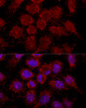 Immunofluorescence analysis of HeLa cells using RPL30 antibody (15-152) at dilution of 1:200. Blue: DAPI for nuclear staining.