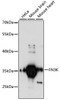 Western blot analysis of extracts of various cell lines, using FN3K antibody (15-166) at 1:3000 dilution.<br/>Secondary antibody: HRP Goat Anti-Rabbit IgG (H+L) at 1:10000 dilution.<br/>Lysates/proteins: 25ug per lane.<br/>Blocking buffer: 3% nonfat dry milk in TBST.<br/>Detection: ECL Basic Kit.<br/>Exposure time: 90s.