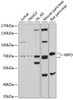 Western blot analysis of extracts of various cell lines, using MPO antibody (15-177) at 1:1000 dilution.<br/>Secondary antibody: HRP Goat Anti-Rabbit IgG (H+L) at 1:10000 dilution.<br/>Lysates/proteins: 25ug per lane.<br/>Blocking buffer: 3% nonfat dry milk in TBST.<br/>Detection: ECL Basic Kit.<br/>Exposure time: 30s.