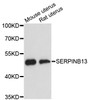Western blot analysis of extracts of various cell lines, using SERPINB13 antibody (15-181) at 1:3000 dilution.<br/>Secondary antibody: HRP Goat Anti-Rabbit IgG (H+L) at 1:10000 dilution.<br/>Lysates/proteins: 25ug per lane.<br/>Blocking buffer: 3% nonfat dry milk in TBST.<br/>Detection: ECL Basic Kit.<br/>Exposure time: 90s.