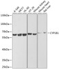 Western blot analysis of extracts of various cell lines, using CYP1B1 antibody (15-193) at 1:1000 dilution.<br/>Secondary antibody: HRP Goat Anti-Rabbit IgG (H+L) at 1:10000 dilution.<br/>Lysates/proteins: 25ug per lane.<br/>Blocking buffer: 3% nonfat dry milk in TBST.<br/>Detection: ECL Enhanced Kit.<br/>Exposure time: 5s.