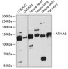 Western blot analysis of extracts of various cell lines, using ATP1A2 antibody (15-211) at 1:3000 dilution.<br/>Secondary antibody: HRP Goat Anti-Rabbit IgG (H+L) at 1:10000 dilution.<br/>Lysates/proteins: 25ug per lane.<br/>Blocking buffer: 3% nonfat dry milk in TBST.<br/>Detection: ECL Basic Kit.<br/>Exposure time: 90s.