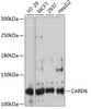 Western blot analysis of extracts of various cell lines, using CARD6 antibody (15-212) at 1:3000 dilution.<br/>Secondary antibody: HRP Goat Anti-Rabbit IgG (H+L) at 1:10000 dilution.<br/>Lysates/proteins: 25ug per lane.<br/>Blocking buffer: 3% nonfat dry milk in TBST.<br/>Detection: ECL Basic Kit.<br/>Exposure time: 30s.