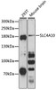 Western blot analysis of extracts of various cell lines, using SLC4A10 antibody (15-213) at 1:3000 dilution.<br/>Secondary antibody: HRP Goat Anti-Rabbit IgG (H+L) at 1:10000 dilution.<br/>Lysates/proteins: 25ug per lane.<br/>Blocking buffer: 3% nonfat dry milk in TBST.<br/>Detection: ECL Basic Kit.<br/>Exposure time: 90s.