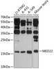 Western blot analysis of extracts of various cell lines, using MED22 antibody (15-221) at 1:3000 dilution.<br/>Secondary antibody: HRP Goat Anti-Rabbit IgG (H+L) at 1:10000 dilution.<br/>Lysates/proteins: 25ug per lane.<br/>Blocking buffer: 3% nonfat dry milk in TBST.<br/>Detection: ECL Enhanced Kit.<br/>Exposure time: 30s.