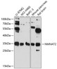 Western blot analysis of extracts of various cell lines, using NMNAT2 antibody (15-223) at 1:3000 dilution.<br/>Secondary antibody: HRP Goat Anti-Rabbit IgG (H+L) at 1:10000 dilution.<br/>Lysates/proteins: 25ug per lane.<br/>Blocking buffer: 3% nonfat dry milk in TBST.<br/>Detection: ECL Basic Kit.<br/>Exposure time: 60s.