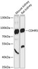 Western blot analysis of extracts of various cell lines, using CDHR5 antibody (15-232) at 1:3000 dilution.<br/>Secondary antibody: HRP Goat Anti-Rabbit IgG (H+L) at 1:10000 dilution.<br/>Lysates/proteins: 25ug per lane.<br/>Blocking buffer: 3% nonfat dry milk in TBST.<br/>Detection: ECL Basic Kit.<br/>Exposure time: 90s.