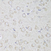 Immunohistochemistry of paraffin-embedded rat brain using GANAB antibody (15-233) at dilution of 1:150 (40x lens) .