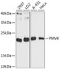 Western blot analysis of extracts of various cell lines, using PMVK antibody (15-239) at 1:3000 dilution.<br/>Secondary antibody: HRP Goat Anti-Rabbit IgG (H+L) at 1:10000 dilution.<br/>Lysates/proteins: 25ug per lane.<br/>Blocking buffer: 3% nonfat dry milk in TBST.<br/>Detection: ECL Basic Kit.<br/>Exposure time: 90s.