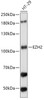 Western blot analysis of extracts of HT-29 cells, using EZH2 antibody (15-240) at 1:1000 dilution.<br/>Secondary antibody: HRP Goat Anti-Rabbit IgG (H+L) at 1:10000 dilution.<br/>Lysates/proteins: 25ug per lane.<br/>Blocking buffer: 3% nonfat dry milk in TBST.<br/>Detection: ECL Basic Kit.<br/>Exposure time: 10s.