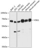 Western blot analysis of extracts of various cell lines, using VSIG1 antibody (15-245) at 1:3000 dilution.<br/>Secondary antibody: HRP Goat Anti-Rabbit IgG (H+L) at 1:10000 dilution.<br/>Lysates/proteins: 25ug per lane.<br/>Blocking buffer: 3% nonfat dry milk in TBST.<br/>Detection: ECL Basic Kit.<br/>Exposure time: 90s.