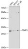 Western blot analysis of extracts of various cell lines, using TIMP1 antibody (15-251) at 1:3000 dilution.<br/>Secondary antibody: HRP Goat Anti-Rabbit IgG (H+L) at 1:10000 dilution.<br/>Lysates/proteins: 25ug per lane.<br/>Blocking buffer: 3% nonfat dry milk in TBST.<br/>Detection: ECL Basic Kit.<br/>Exposure time: 90s.