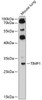 Western blot analysis of extracts of mouse lung, using TIMP1 antibody (15-251) at 1:3000 dilution.<br/>Secondary antibody: HRP Goat Anti-Rabbit IgG (H+L) at 1:10000 dilution.<br/>Lysates/proteins: 25ug per lane.<br/>Blocking buffer: 3% nonfat dry milk in TBST.<br/>Detection: ECL Enhanced Kit.<br/>Exposure time: 90s.