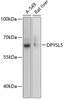 Western blot analysis of extracts of various cell lines, using DPYSL5 antibody (15-253) at 1:3000 dilution.<br/>Secondary antibody: HRP Goat Anti-Rabbit IgG (H+L) at 1:10000 dilution.<br/>Lysates/proteins: 25ug per lane.<br/>Blocking buffer: 3% nonfat dry milk in TBST.<br/>Detection: ECL Basic Kit.<br/>Exposure time: 1s.