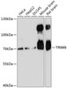 Western blot analysis of extracts of various cell lines, using TRIM9 antibody (15-256) at 1:3000 dilution.<br/>Secondary antibody: HRP Goat Anti-Rabbit IgG (H+L) at 1:10000 dilution.<br/>Lysates/proteins: 25ug per lane.<br/>Blocking buffer: 3% nonfat dry milk in TBST.<br/>Detection: ECL Basic Kit.<br/>Exposure time: 90s.