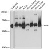 Western blot analysis of extracts of various cell lines, using PKM antibody (15-259) at 1:1000 dilution.<br/>Secondary antibody: HRP Goat Anti-Rabbit IgG (H+L) at 1:10000 dilution.<br/>Lysates/proteins: 25ug per lane.<br/>Blocking buffer: 3% nonfat dry milk in TBST.<br/>Detection: ECL Basic Kit.<br/>Exposure time: 1s.