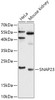 Western blot analysis of extracts of various cell lines, using SNAP23 antibody (15-261) at 1:1000 dilution.<br/>Secondary antibody: HRP Goat Anti-Rabbit IgG (H+L) at 1:10000 dilution.<br/>Lysates/proteins: 25ug per lane.<br/>Blocking buffer: 3% nonfat dry milk in TBST.<br/>Detection: ECL Basic Kit.<br/>Exposure time: 2min.