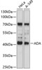 Western blot analysis of extracts of various cell lines, using ADA antibody (15-263) at 1:1000 dilution.<br/>Secondary antibody: HRP Goat Anti-Rabbit IgG (H+L) at 1:10000 dilution.<br/>Lysates/proteins: 25ug per lane.<br/>Blocking buffer: 3% nonfat dry milk in TBST.<br/>Detection: ECL Basic Kit.<br/>Exposure time: 10s.