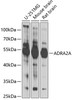 Western blot analysis of extracts of various cell lines, using ADRA2A antibody (15-280) at 1:1000 dilution.<br/>Secondary antibody: HRP Goat Anti-Rabbit IgG (H+L) at 1:10000 dilution.<br/>Lysates/proteins: 25ug per lane.<br/>Blocking buffer: 3% nonfat dry milk in TBST.<br/>Detection: ECL Basic Kit.<br/>Exposure time: 20s.
