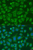Immunofluorescence analysis of U2OS cells using FCGR3B antibody (15-304) at dilution of 1:100. Blue: DAPI for nuclear staining.
