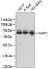 Western blot analysis of extracts of various cell lines, using G6PD antibody (15-305) at 1:1000 dilution.<br/>Secondary antibody: HRP Goat Anti-Rabbit IgG (H+L) at 1:10000 dilution.<br/>Lysates/proteins: 25ug per lane.<br/>Blocking buffer: 3% nonfat dry milk in TBST.