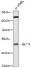 Western blot analysis of extracts of U-87MG cells, using GLP1R antibody (15-309) at 1:1000 dilution.<br/>Secondary antibody: HRP Goat Anti-Rabbit IgG (H+L) at 1:10000 dilution.<br/>Lysates/proteins: 25ug per lane.<br/>Blocking buffer: 3% nonfat dry milk in TBST.<br/>Detection: ECL Basic Kit.<br/>Exposure time: 60s.