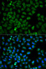 Immunofluorescence analysis of HeLa cells using HSPA8 antibody (15-314) . Blue: DAPI for nuclear staining.