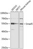 Western blot analysis of extracts of various cell lines, using Smad5 antibody (15-325) at 1:1000 dilution.<br/>Secondary antibody: HRP Goat Anti-Rabbit IgG (H+L) at 1:10000 dilution.<br/>Lysates/proteins: 25ug per lane.<br/>Blocking buffer: 3% nonfat dry milk in TBST.<br/>Detection: ECL Basic Kit.<br/>Exposure time: 30s.