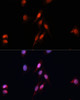 Immunofluorescence analysis of HeLa cells using Smad5 Polyclonal Antibody (15-325) at dilution of 1:100 (40x lens) . Blue: DAPI for nuclear staining.