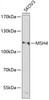 Western blot analysis of extracts of SKOV3 cells, using MSH4 antibody (15-328) at 1:1000 dilution.<br/>Secondary antibody: HRP Goat Anti-Rabbit IgG (H+L) at 1:10000 dilution.<br/>Lysates/proteins: 25ug per lane.<br/>Blocking buffer: 3% nonfat dry milk in TBST.<br/>Detection: ECL Enhanced Kit.<br/>Exposure time: 90s.