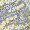 Immunohistochemistry of paraffin-embedded rat intestine using PGK1 Antibody (15-337) at dilution of 1:100 (40x lens) .