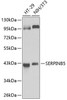 Western blot analysis of extracts of various cell lines, using SERPINB5 antibody (15-339) at 1:1000 dilution.<br/>Secondary antibody: HRP Goat Anti-Rabbit IgG (H+L) at 1:10000 dilution.<br/>Lysates/proteins: 25ug per lane.<br/>Blocking buffer: 3% nonfat dry milk in TBST.