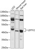 Western blot analysis of extracts of various cell lines, using LEFTY2 antibody (15-353) at 1:1000 dilution.<br/>Secondary antibody: HRP Goat Anti-Rabbit IgG (H+L) at 1:10000 dilution.<br/>Lysates/proteins: 25ug per lane.<br/>Blocking buffer: 3% nonfat dry milk in TBST.<br/>Detection: ECL Basic Kit.<br/>Exposure time: 5s.