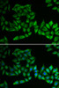 Immunofluorescence analysis of U2OS cells using TPMT antibody (15-354) . Blue: DAPI for nuclear staining.