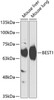 Western blot analysis of extracts of various cell lines, using BEST1 antibody (15-355) at 1:1000 dilution.<br/>Secondary antibody: HRP Goat Anti-Rabbit IgG (H+L) at 1:10000 dilution.<br/>Lysates/proteins: 25ug per lane.<br/>Blocking buffer: 3% nonfat dry milk in TBST.