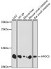 Western blot analysis of extracts of various cell lines, using APOC3 antibody (15-365) at 1:1000 dilution.<br/>Secondary antibody: HRP Goat Anti-Rabbit IgG (H+L) at 1:10000 dilution.<br/>Lysates/proteins: 25ug per lane.<br/>Blocking buffer: 3% nonfat dry milk in TBST.<br/>Detection: ECL Basic Kit.<br/>Exposure time: 30s.