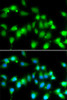 Immunofluorescence analysis of HeLa cells using AKAP5 antibody (15-366) at dilution of 1:100. Blue: DAPI for nuclear staining.