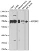 Western blot analysis of extracts of various cell lines, using IGF2BP2 antibody (15-372) at 1:1000 dilution.<br/>Secondary antibody: HRP Goat Anti-Rabbit IgG (H+L) at 1:10000 dilution.<br/>Lysates/proteins: 25ug per lane.<br/>Blocking buffer: 3% nonfat dry milk in TBST.<br/>Detection: ECL Enhanced Kit.<br/>Exposure time: 10s.