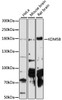 Western blot analysis of extracts of various cell lines, using KDM5B antibody (15-373) at 1:1000 dilution.<br/>Secondary antibody: HRP Goat Anti-Rabbit IgG (H+L) at 1:10000 dilution.<br/>Lysates/proteins: 25ug per lane.<br/>Blocking buffer: 3% nonfat dry milk in TBST.<br/>Detection: ECL Basic Kit.<br/>Exposure time: 90s.