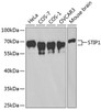 Western blot analysis of extracts of various cell lines, using STIP1 antibody (15-375) at 1:1000 dilution.<br/>Secondary antibody: HRP Goat Anti-Rabbit IgG (H+L) at 1:10000 dilution.<br/>Lysates/proteins: 25ug per lane.<br/>Blocking buffer: 3% nonfat dry milk in TBST.