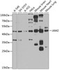 Western blot analysis of extracts of various cell lines, using JAM2 antibody (15-397) at 1:1000 dilution.<br/>Secondary antibody: HRP Goat Anti-Rabbit IgG (H+L) at 1:10000 dilution.<br/>Lysates/proteins: 25ug per lane.<br/>Blocking buffer: 3% nonfat dry milk in TBST.<br/>Detection: ECL Basic Kit.<br/>Exposure time: 90s.