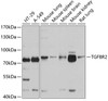 Western blot analysis of extracts of various cell lines, using TGFBR2 antibody (15-398) at 1:1000 dilution.<br/>Secondary antibody: HRP Goat Anti-Rabbit IgG (H+L) at 1:10000 dilution.<br/>Lysates/proteins: 25ug per lane.<br/>Blocking buffer: 3% nonfat dry milk in TBST.<br/>Detection: ECL Basic Kit.<br/>Exposure time: 3s.