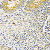 Immunohistochemistry of paraffin-embedded human appendix using TGFBR2 antibody (15-398) at dilution of 1:100 (40x lens) .