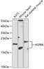 Western blot analysis of extracts of various cell lines, using HSPB6 antibody (15-401) at 1:1000 dilution.<br/>Secondary antibody: HRP Goat Anti-Rabbit IgG (H+L) at 1:10000 dilution.<br/>Lysates/proteins: 25ug per lane.<br/>Blocking buffer: 3% nonfat dry milk in TBST.<br/>Detection: ECL Enhanced Kit.<br/>Exposure time: 90s.