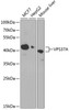 Western blot analysis of extracts of various cell lines, using VPS37A antibody (15-402) at 1:1000 dilution.<br/>Secondary antibody: HRP Goat Anti-Rabbit IgG (H+L) at 1:10000 dilution.<br/>Lysates/proteins: 25ug per lane.<br/>Blocking buffer: 3% nonfat dry milk in TBST.<br/>Detection: ECL Basic Kit.<br/>Exposure time: 90s.
