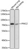 Western blot analysis of extracts of various cell lines, using PRKCZ antibody (15-411) at 1:1000 dilution.<br/>Secondary antibody: HRP Goat Anti-Rabbit IgG (H+L) at 1:10000 dilution.<br/>Lysates/proteins: 25ug per lane.<br/>Blocking buffer: 3% nonfat dry milk in TBST.<br/>Detection: ECL Basic Kit.<br/>Exposure time: 1s.