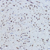 Immunohistochemistry of paraffin-embedded human uterus using ESRRA antibody (15-414) at dilution of 1:200 (40x lens) .