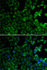 Immunofluorescence analysis of HeLa cells using MSR1 antibody (15-416) . Blue: DAPI for nuclear staining.