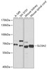 Western blot analysis of extracts of various cell lines, using SLC6A2 antibody (15-429) at 1:1000 dilution.<br/>Secondary antibody: HRP Goat Anti-Rabbit IgG (H+L) at 1:10000 dilution.<br/>Lysates/proteins: 25ug per lane.<br/>Blocking buffer: 3% nonfat dry milk in TBST.<br/>Detection: ECL Basic Kit.<br/>Exposure time: 10s.